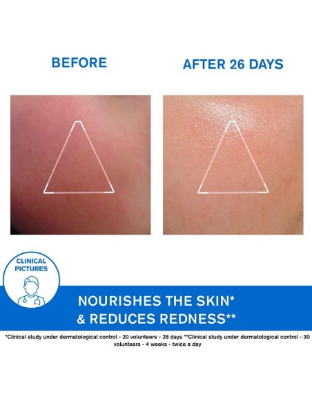 Xemose Crema Facial 40Ml. de Uriage